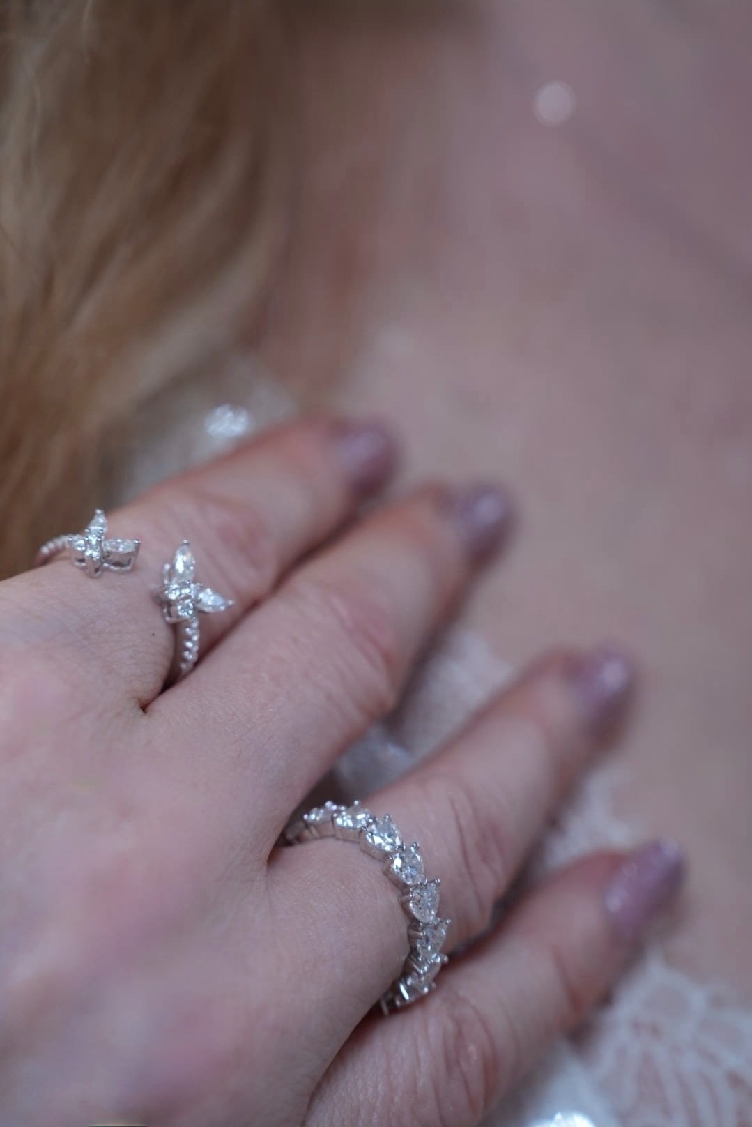 Open ring
